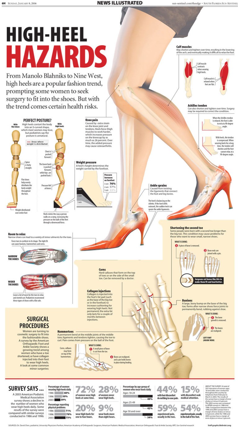 High-Heel Hazards Infographic